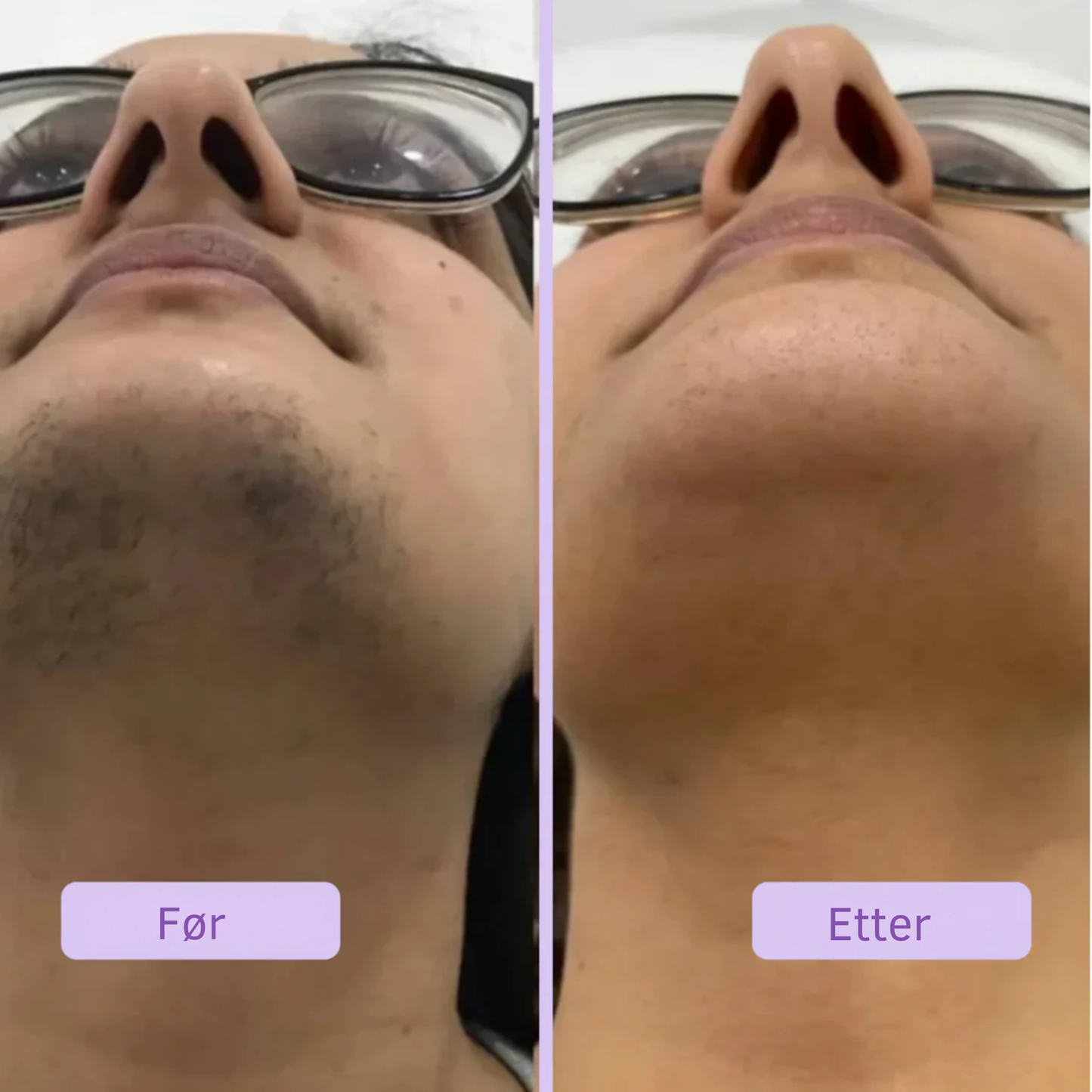 Flamingo™ Hårfjerningskrem