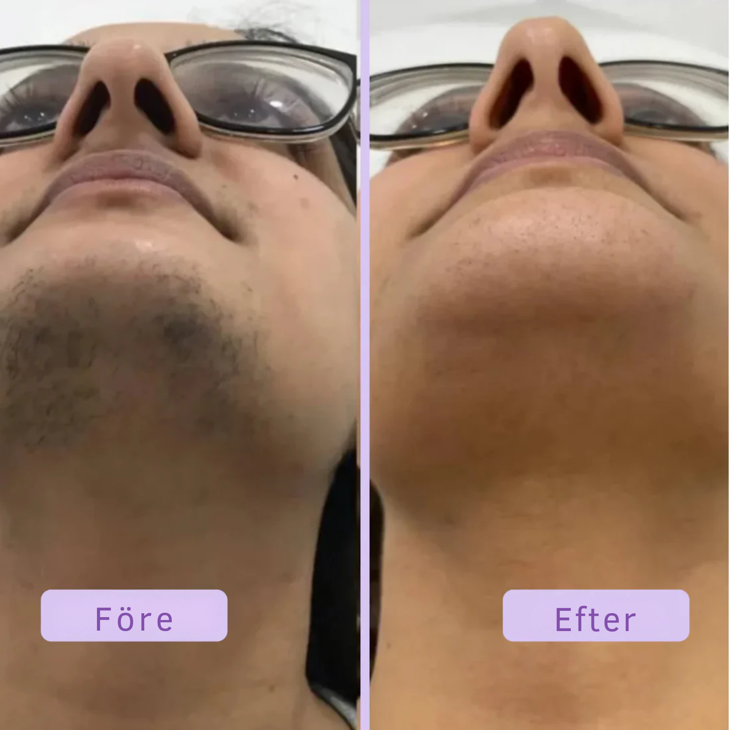 Flamingo™ Hair Remover Cream